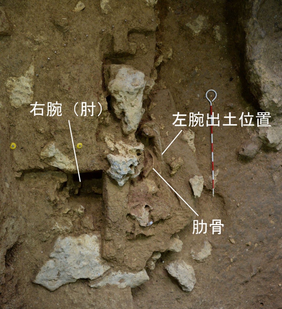 写真３　人骨の検出状況(2)。頭部、胸部、腹部、右腕の位置で石灰岩礫が検出されました。